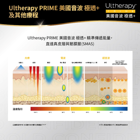 為什麼要將能量精準送達 SMAS 筋膜層?