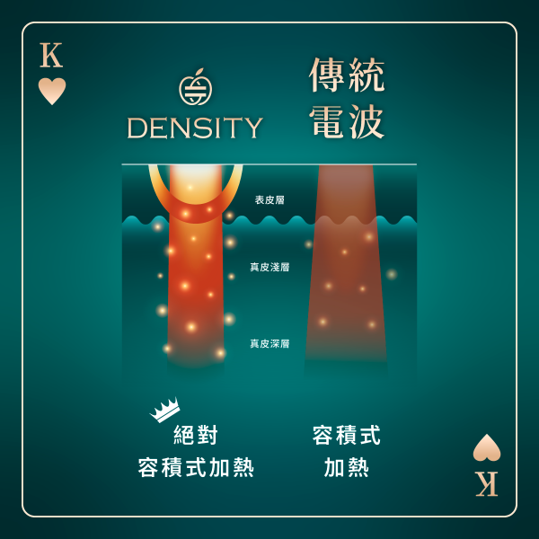 一張表看懂無雙電波與鳳凰電波的 6 大差異