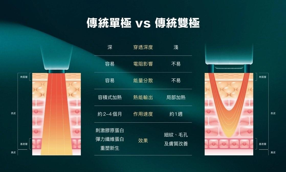 無雙電波、鳳凰電波、海芙音波怎麼選?客觀中立比較|瑞麗嘉健康美學診所